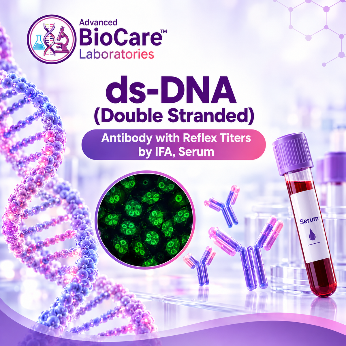 ds-DNA (Double stranded) - Antibody with reflex titers by IFA, Serum