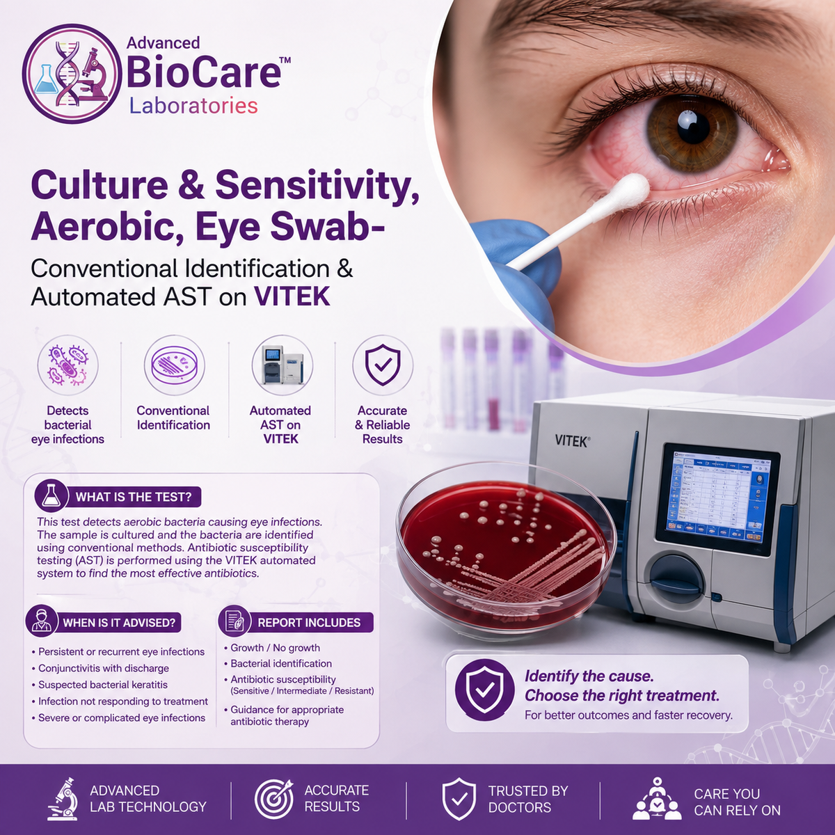 Culture & Sensitivity, Aerobic, Eye swab- Conventional Identification & Automated AST on Vitek