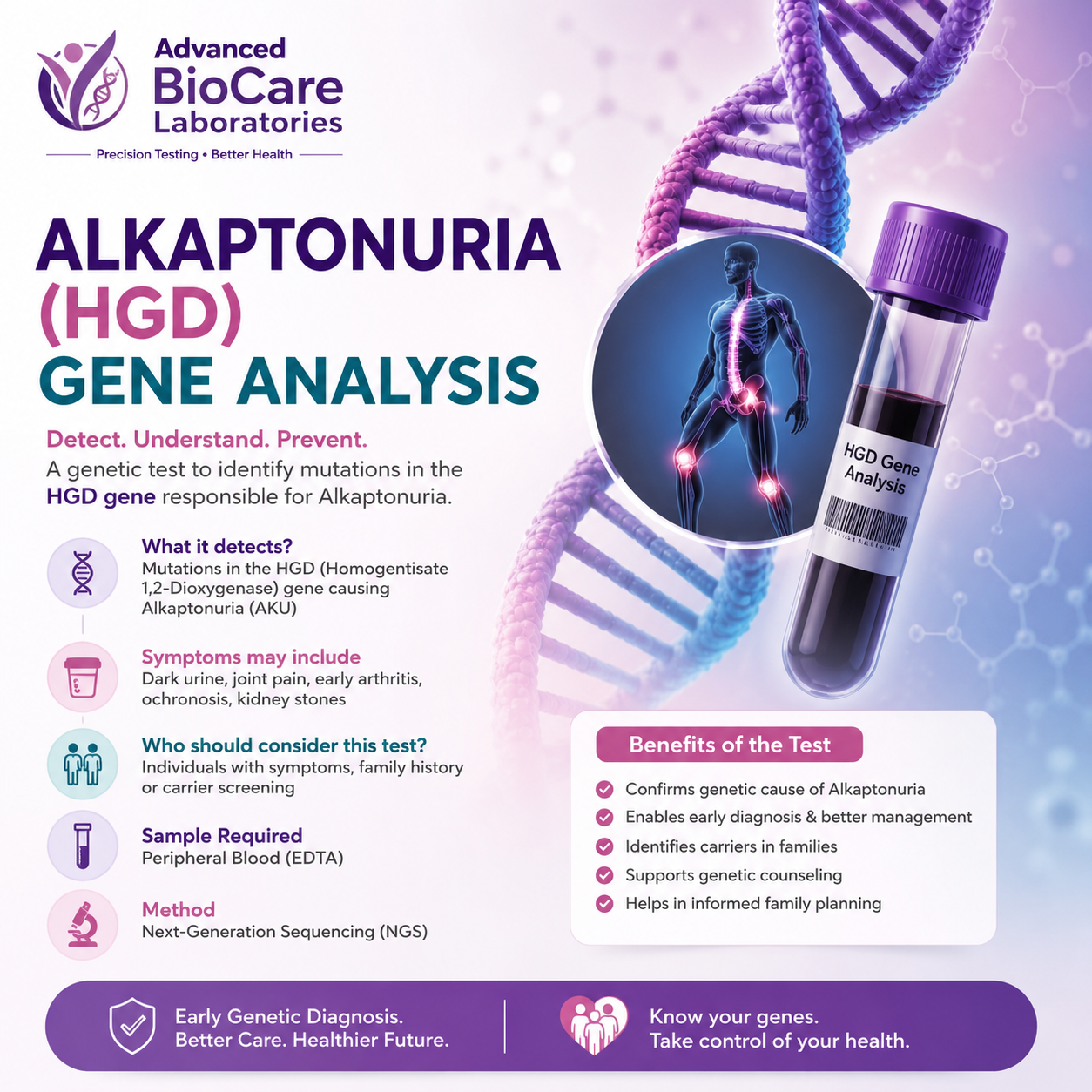 Alkaptonuria(HGD) gene analysis