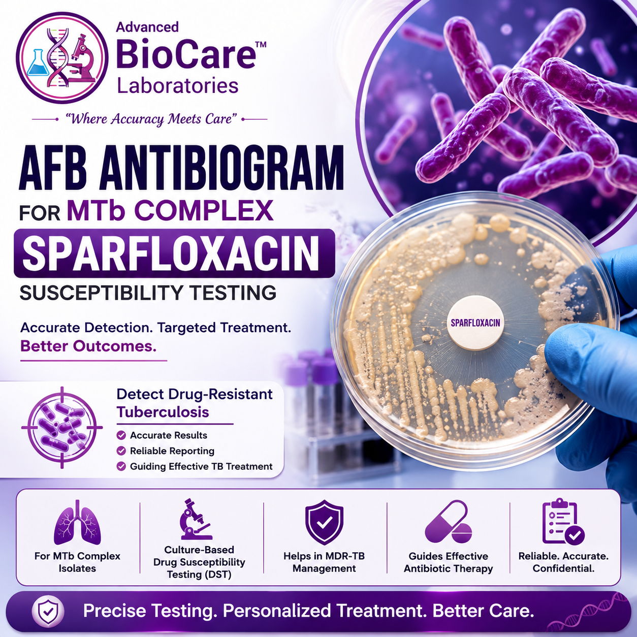 AFB-Antibiogram for MTb complex Sparfloxacin
