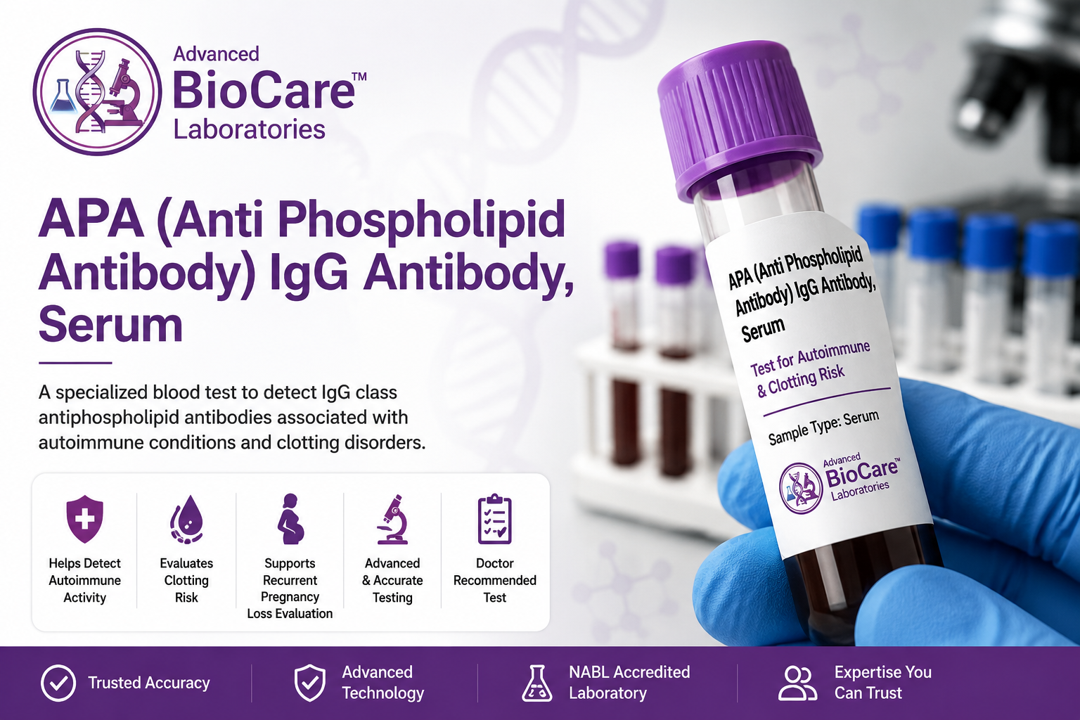 APA (Anti Phospholipid Antibody) - IgA Antibody, Serum