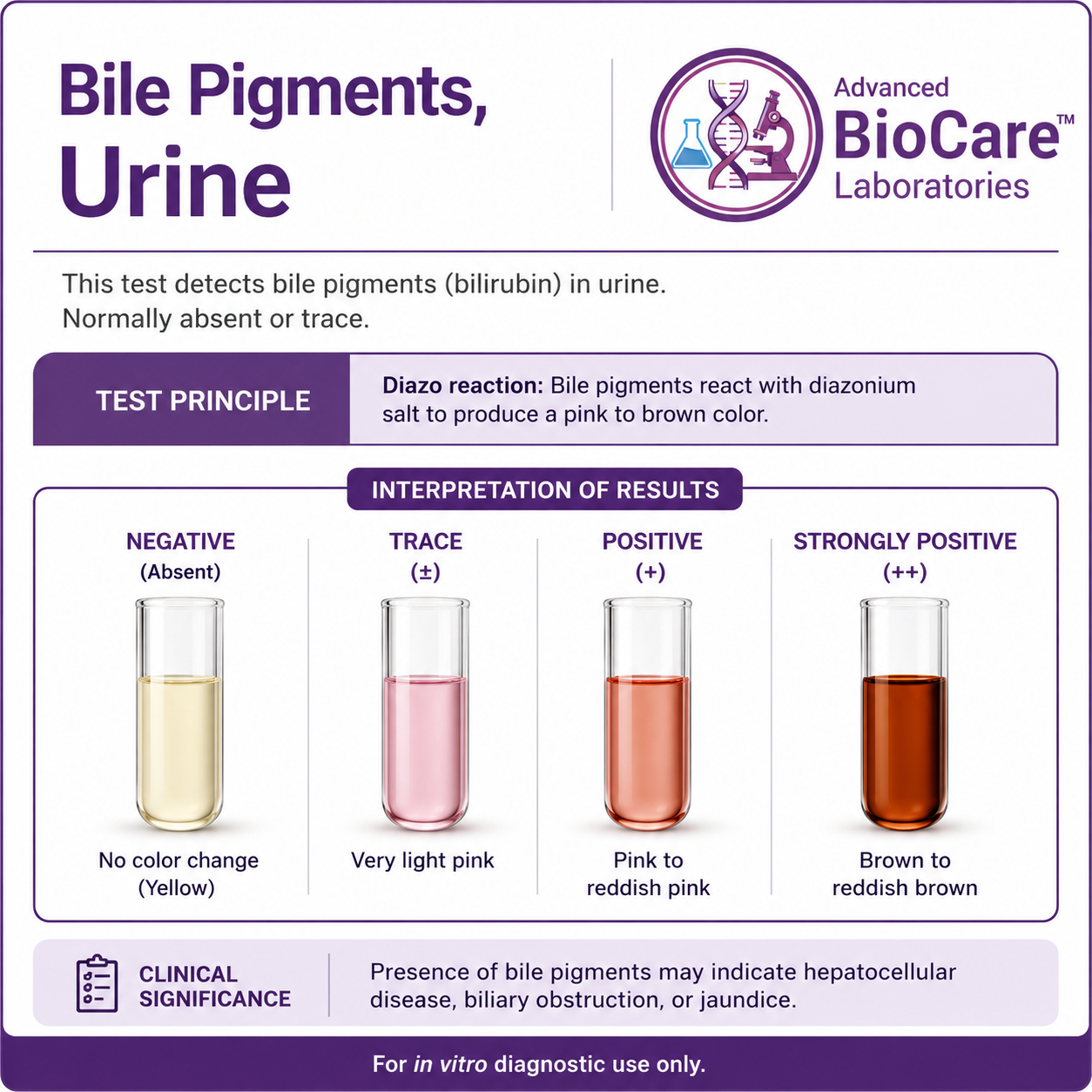 Bile Pigments, Urine