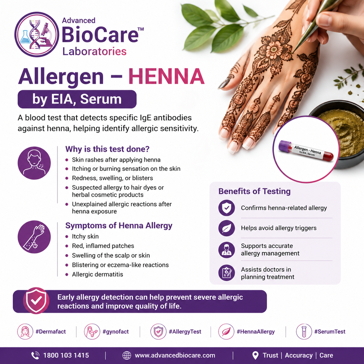 Allergen - HENNA by EIA, Serum