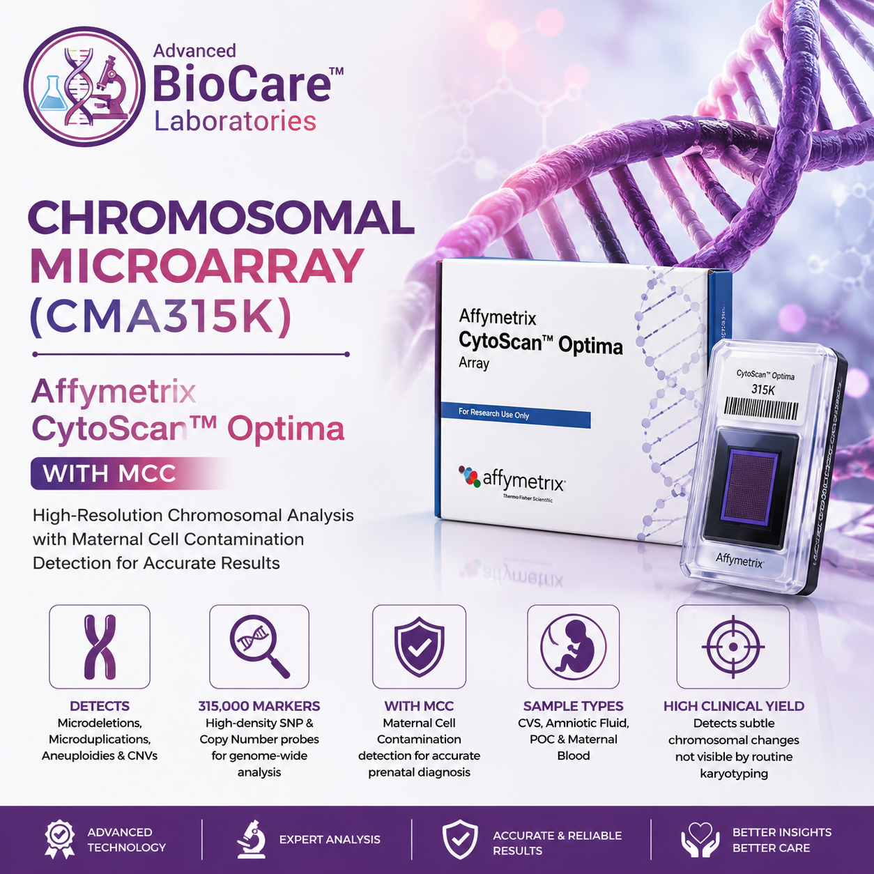Chromosomal Microarray(CMA315k) - Affymetrix Cytoscan Optima With MCC