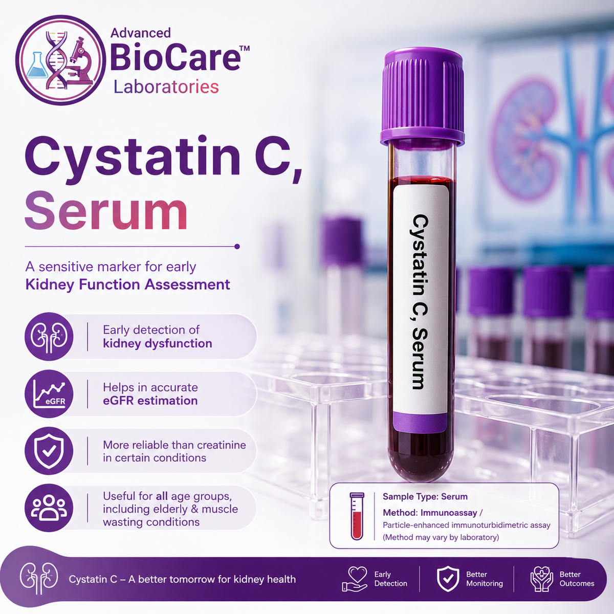 Cystatin C,Serum