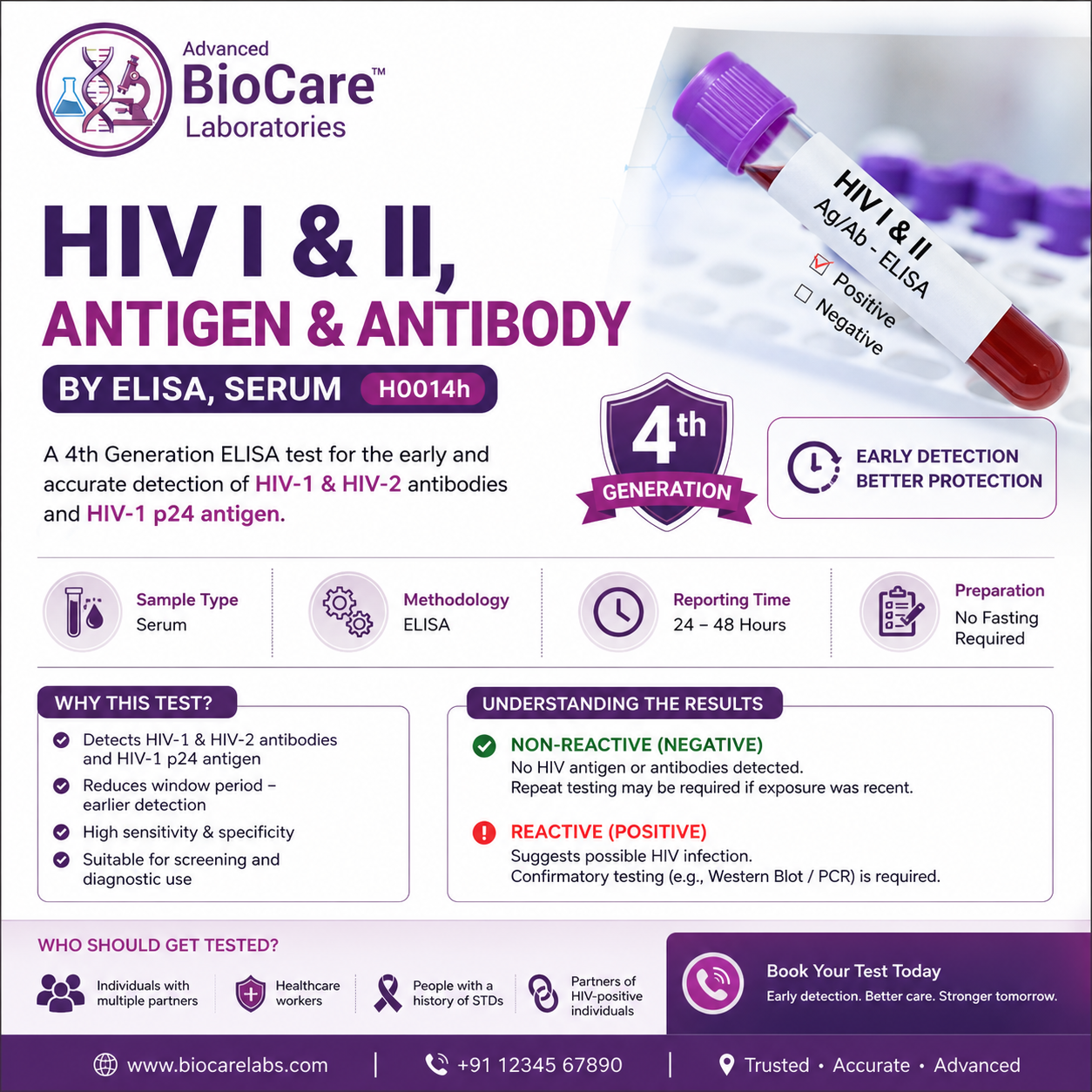 HIV I & II, Antigen & Antibody - by ELISA, Serum
