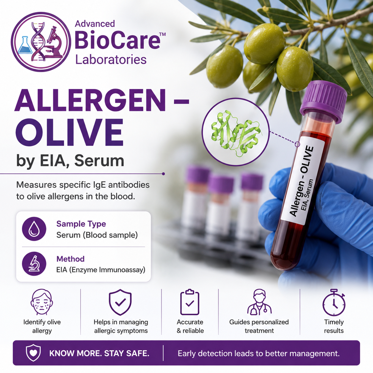 Allergen - OLIVE by EIA, Serum