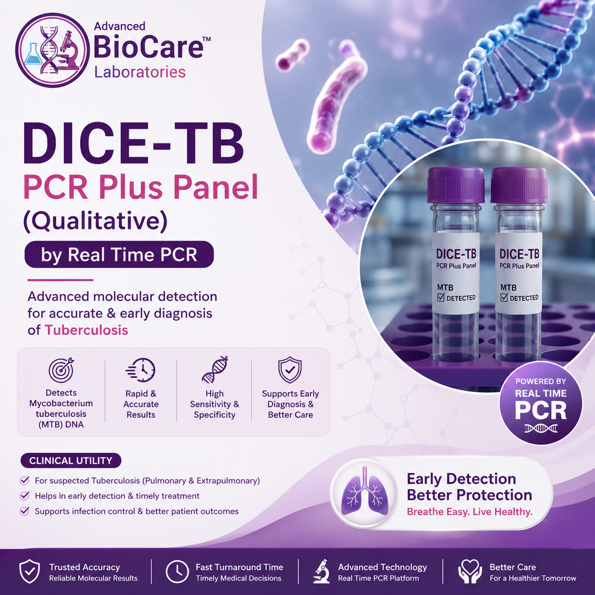 DICE-TB PCR Plus panel (Qualitative) by Real Time PCR