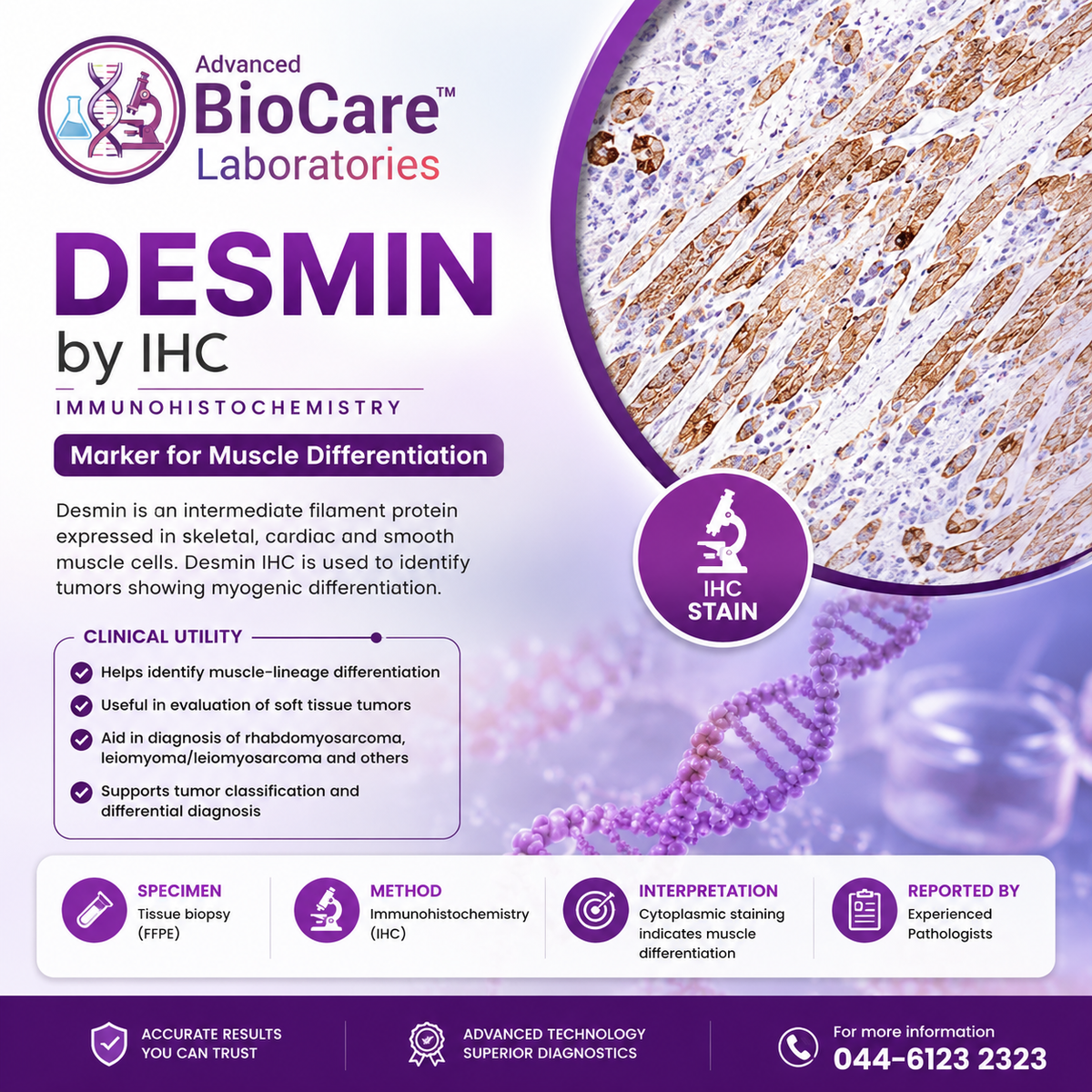Desmin by IHC