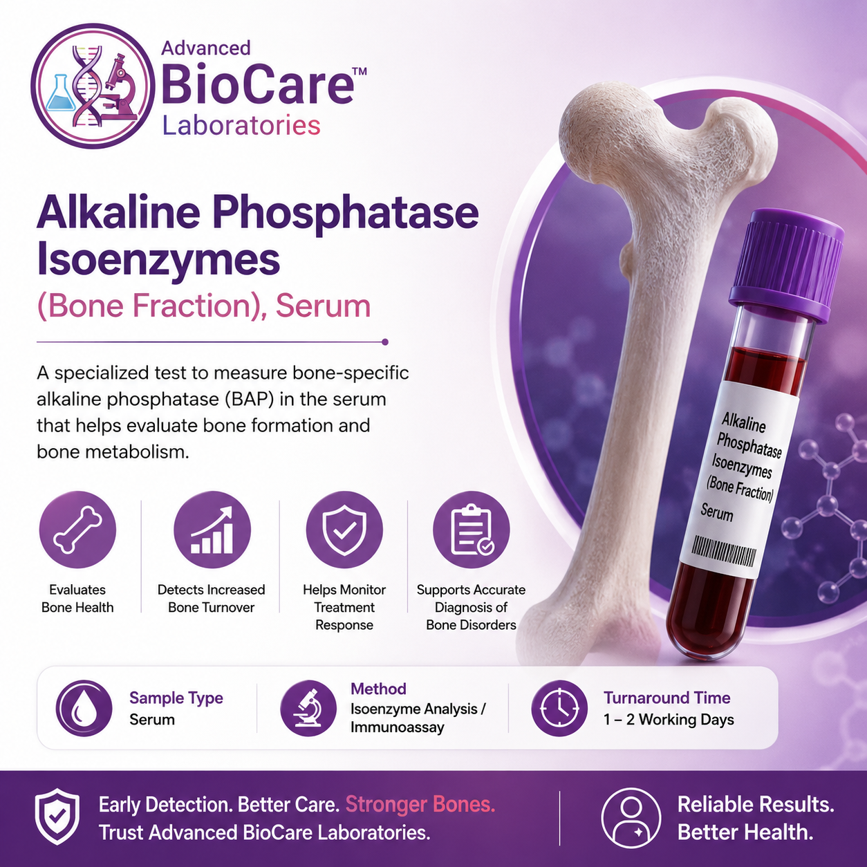 Alkaline Phosphatase Isoenzymes (Bone Fraction), Serum