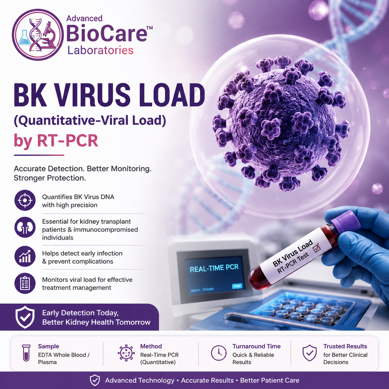 BK Virus Load (Quantitative-Viral Load) by RT-PCR