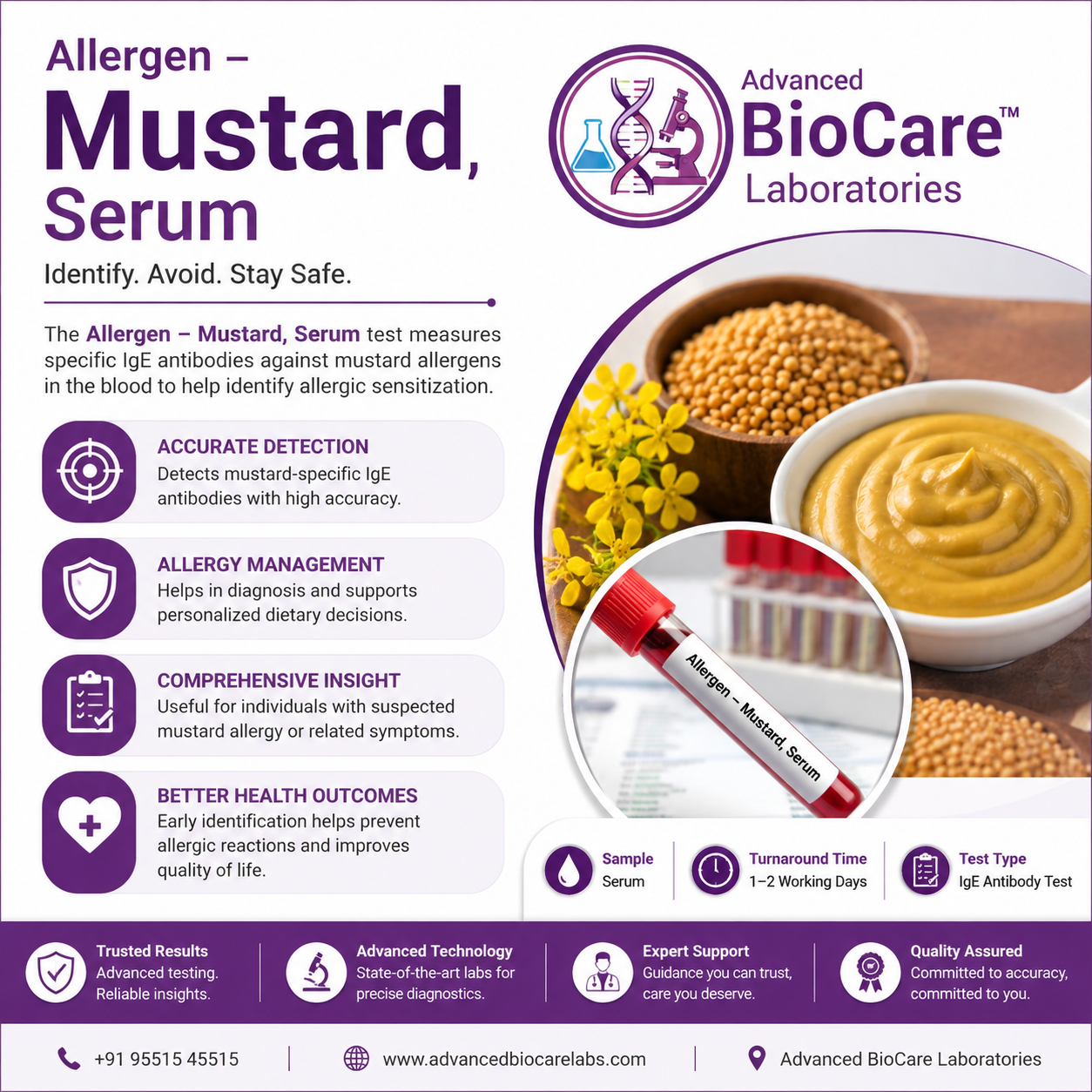 Allergen - MUSTARD by EIA, Serum