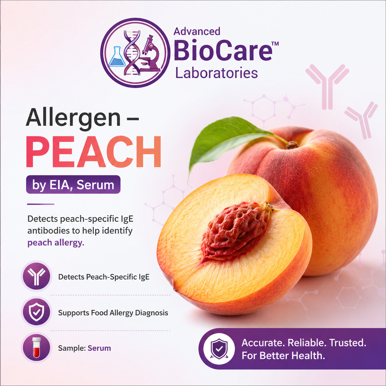 Allergen - PEACH by EIA, Serum
