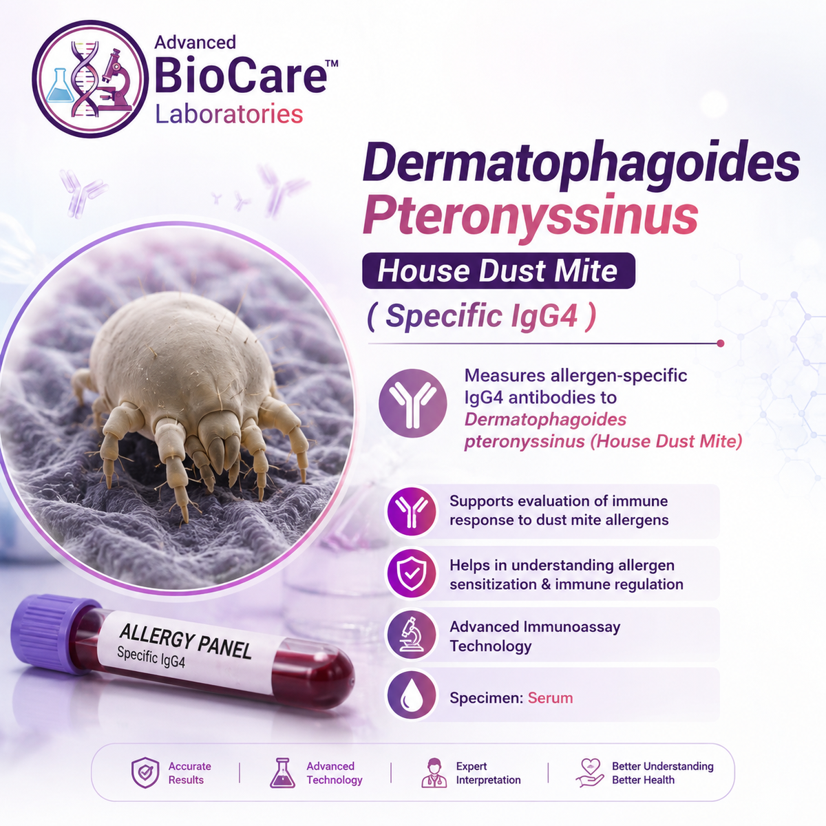 Dermatophagoides Pteronyssinus House Dust mite ( Specific IgG4 )