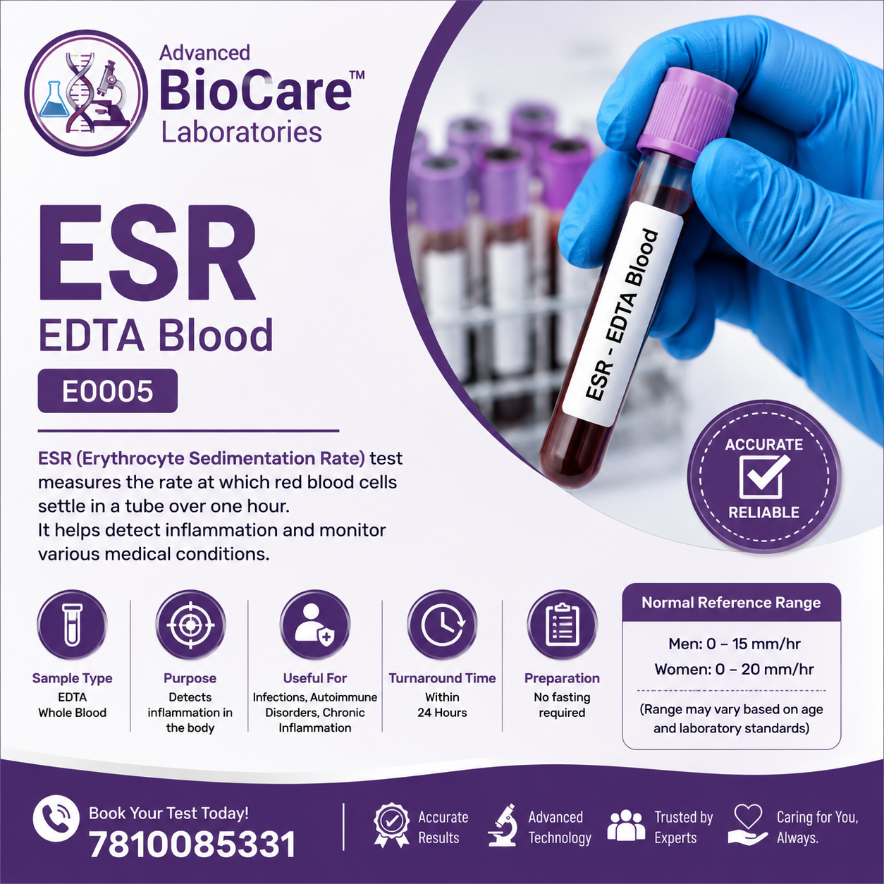 ESR (Erythrocyte Sedimentation Rate), EDTA Blood