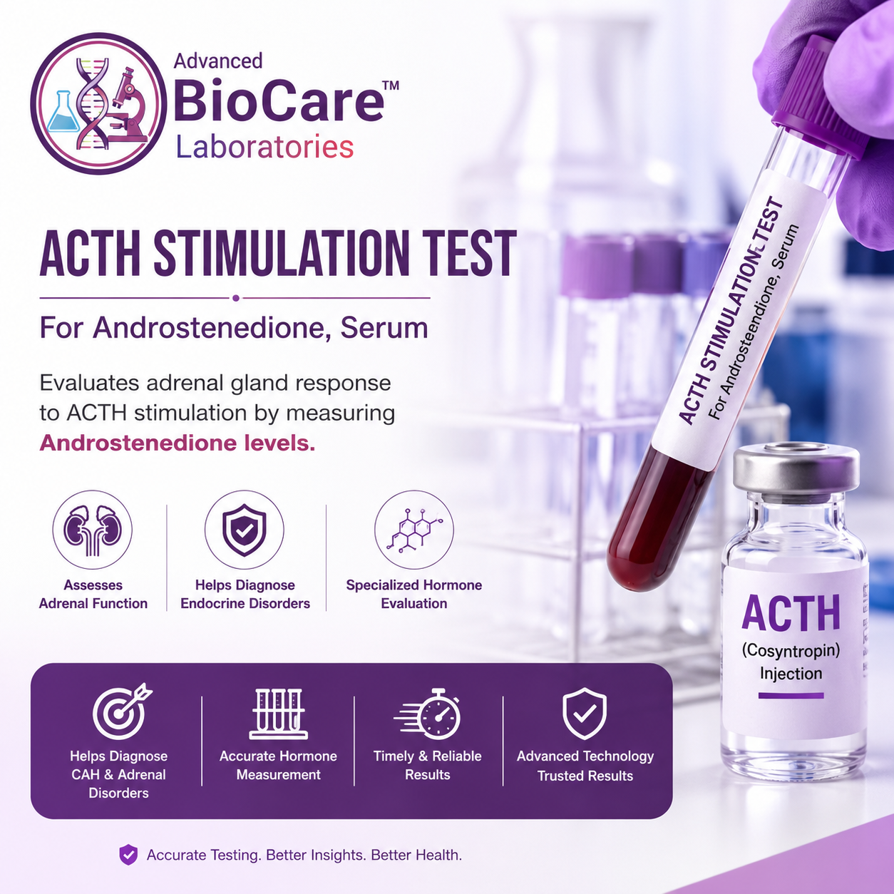ACTH Stimulation Test - For Androsteindione, serum
