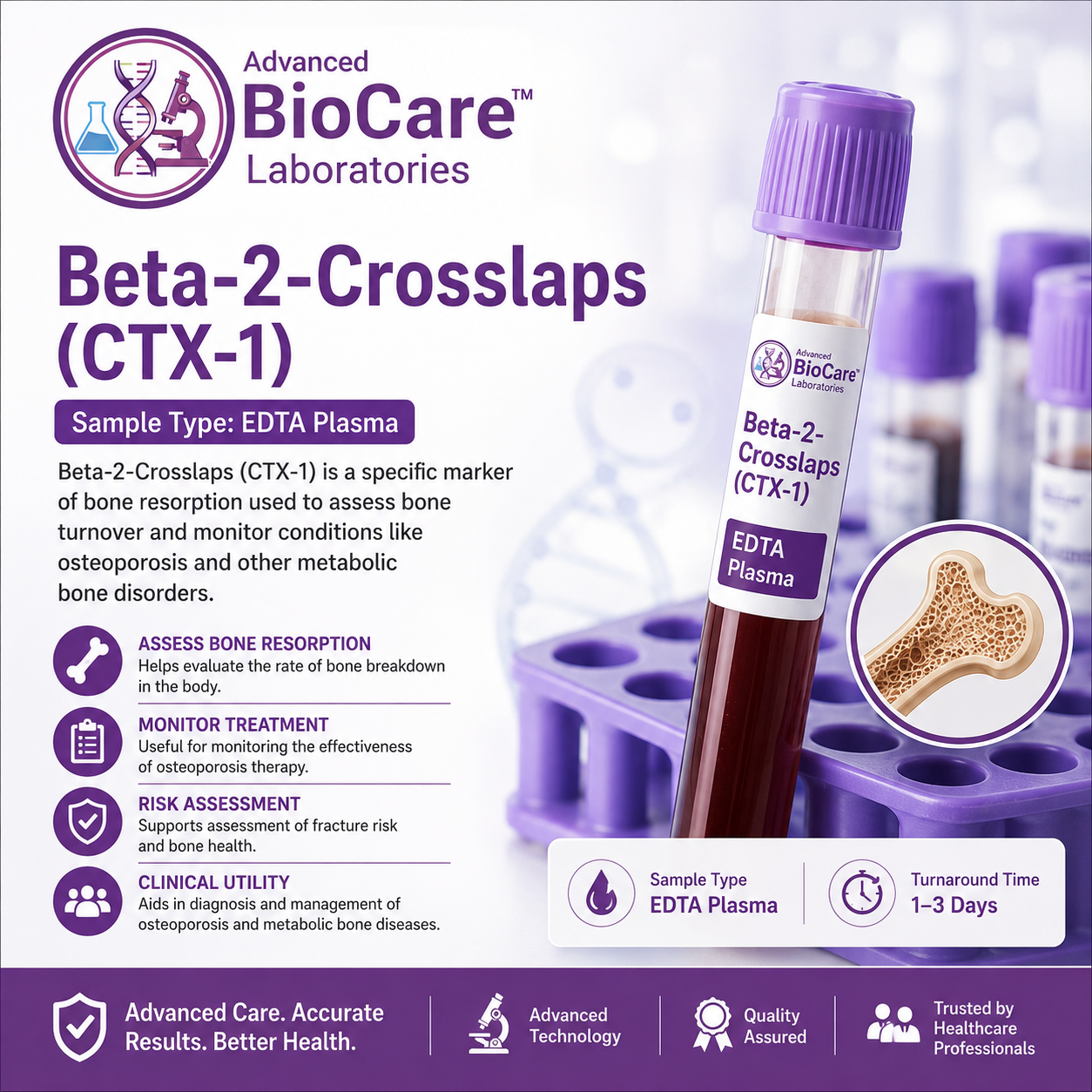 Beta-2-Crosslaps (Ctx-1), EDTA Plasma