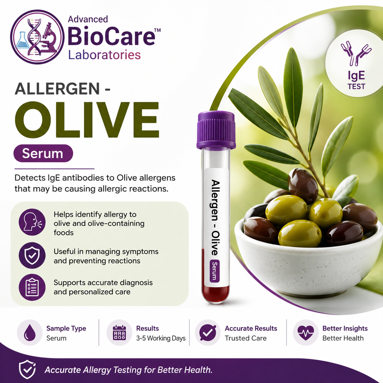 Allergen - Olive, Serum