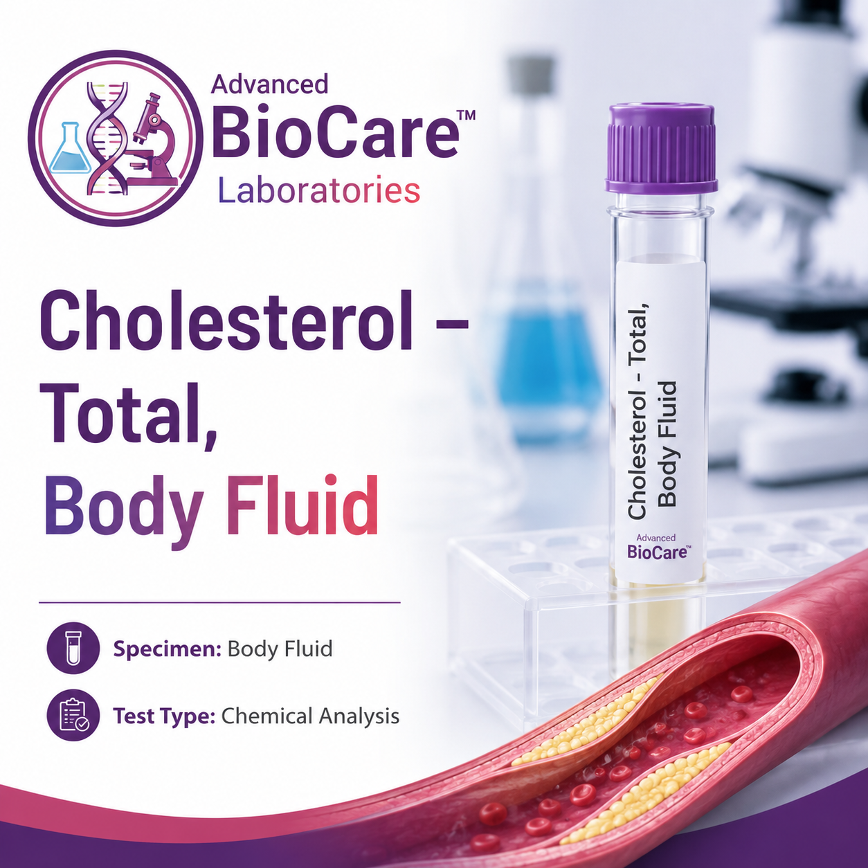 Cholesterol-Total Body Fluid