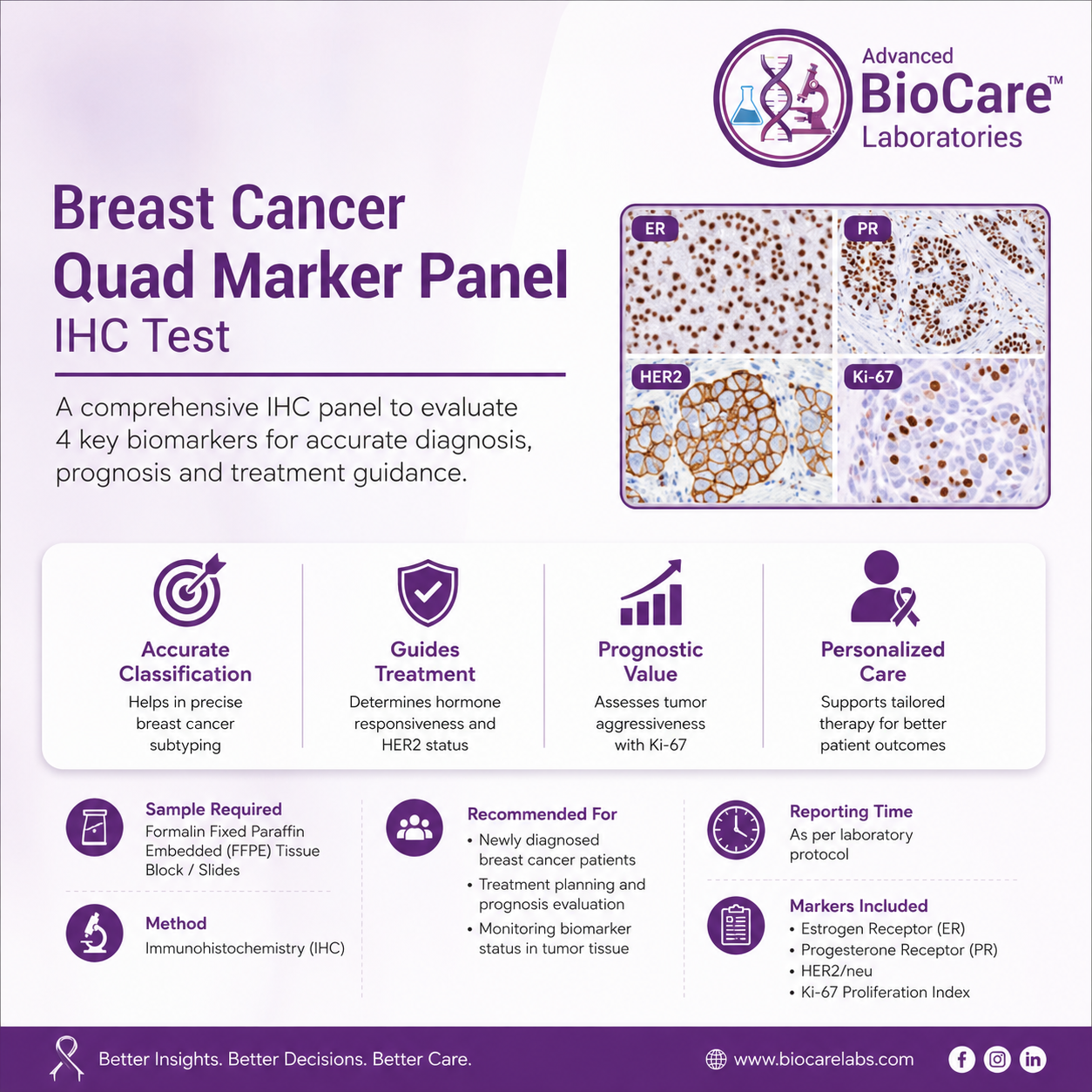 Breast Cancer Quad, IHC