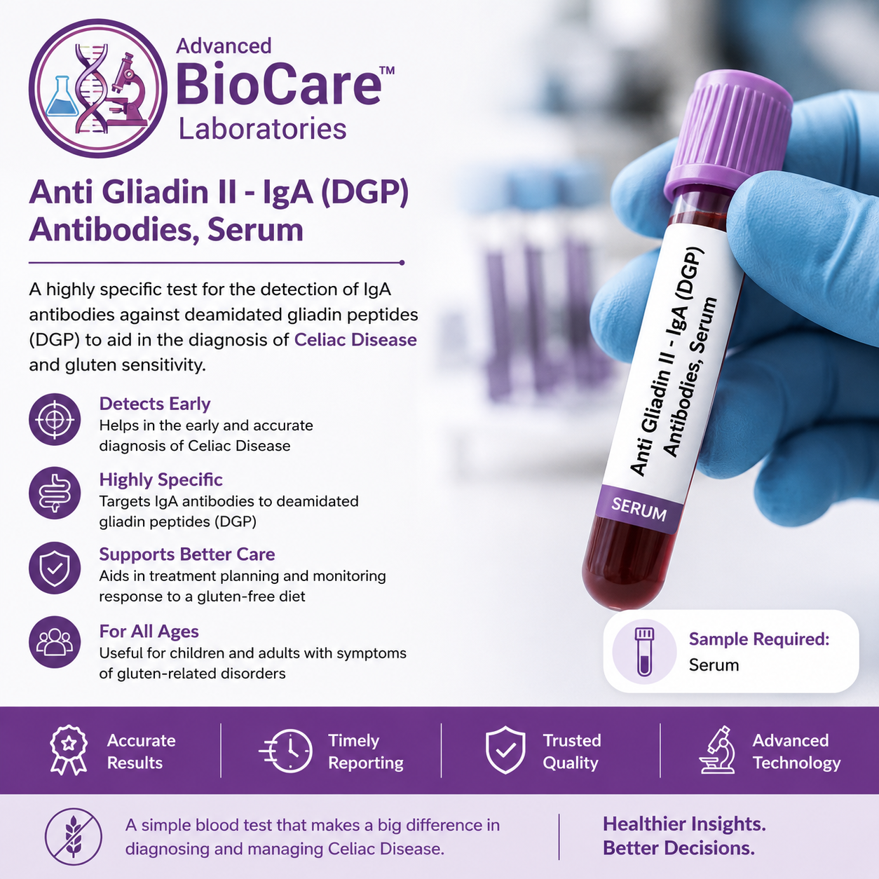 Anti Gliadin Ii- IgA (DGP) Antibodies, Serum