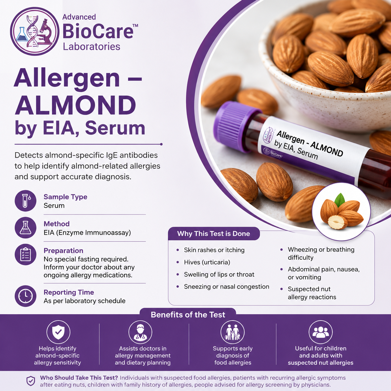 Allergen - ALMOND by EIA, Serum