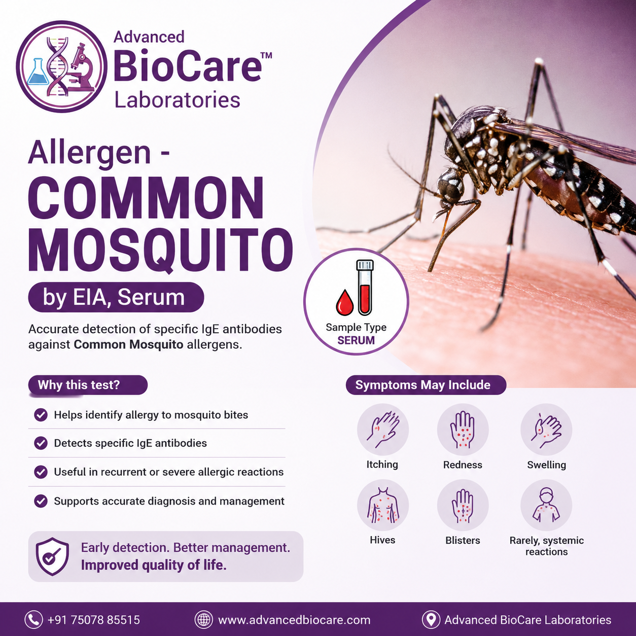 Allergen - COMMON MOSQUITO by EIA, Serum