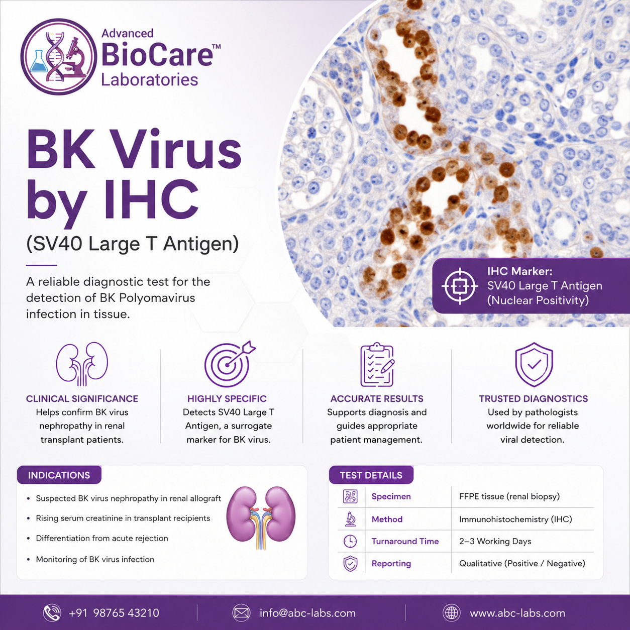BK Virus by IHC