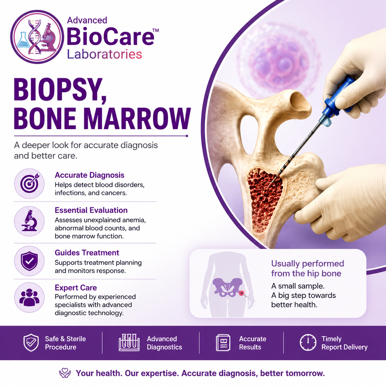 Biopsy, Bone Marrow
