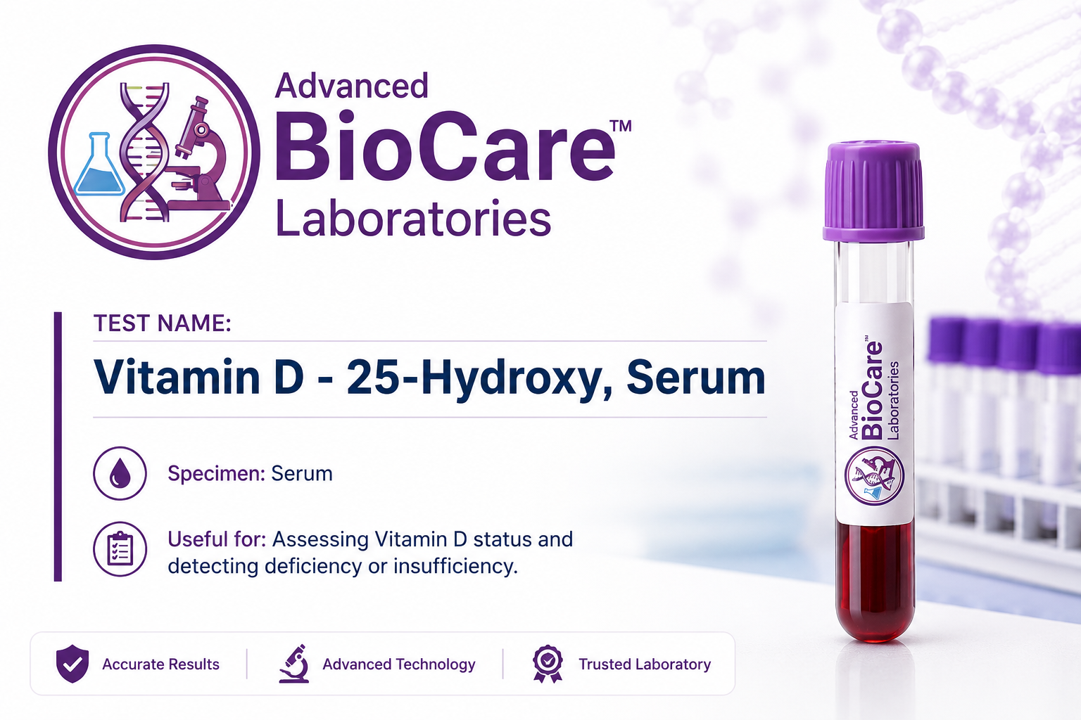 Vitamin D - 25-Hydroxy, Serum