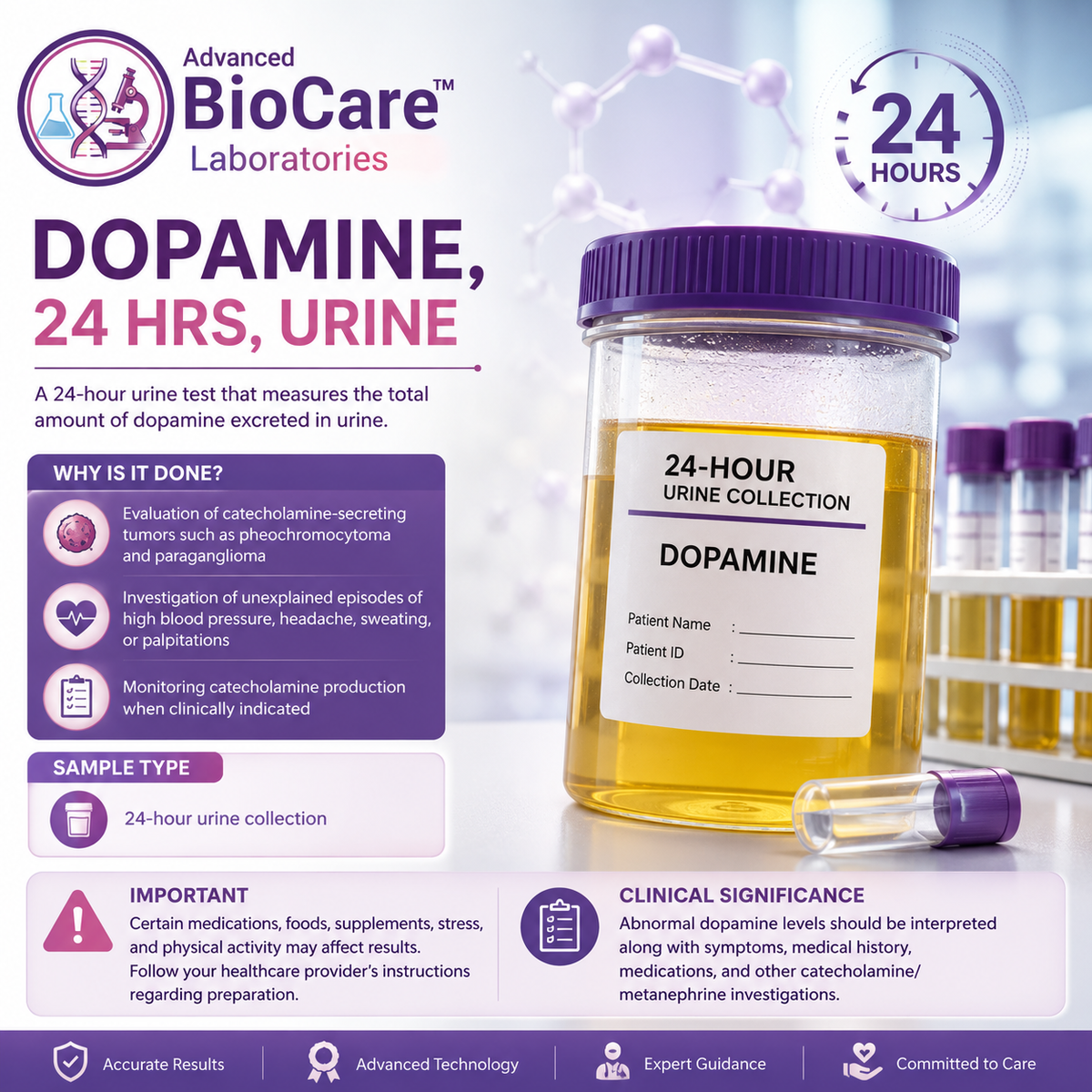 Dopamine,24 hrs, Urine