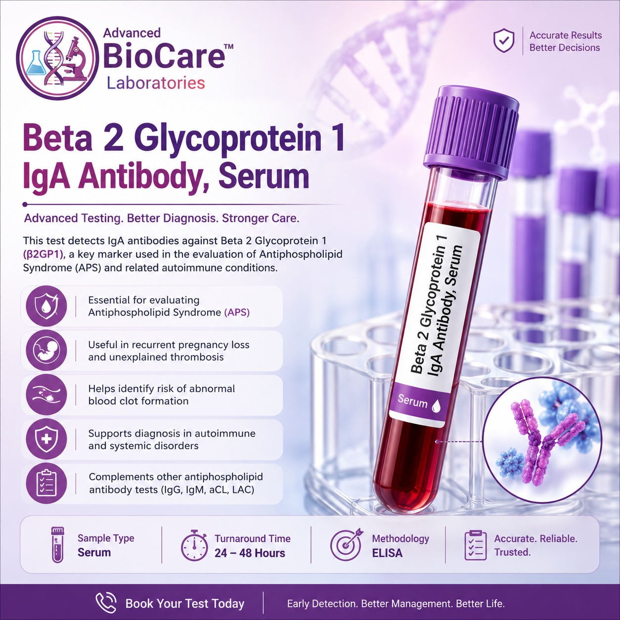Beta 2 Glycoprotein 1 - IgA Antibody, Serum