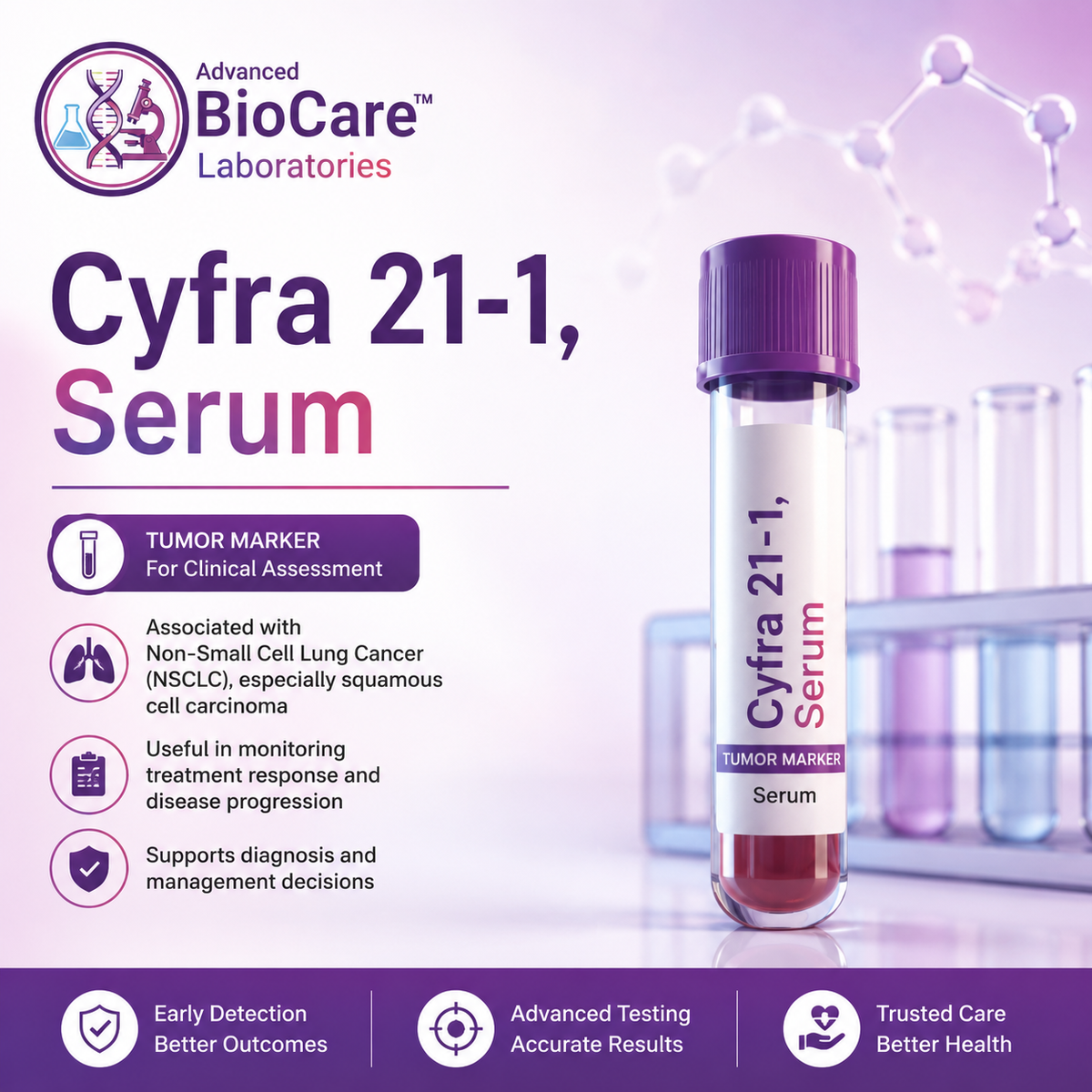 Cyfra 21-1, Serum