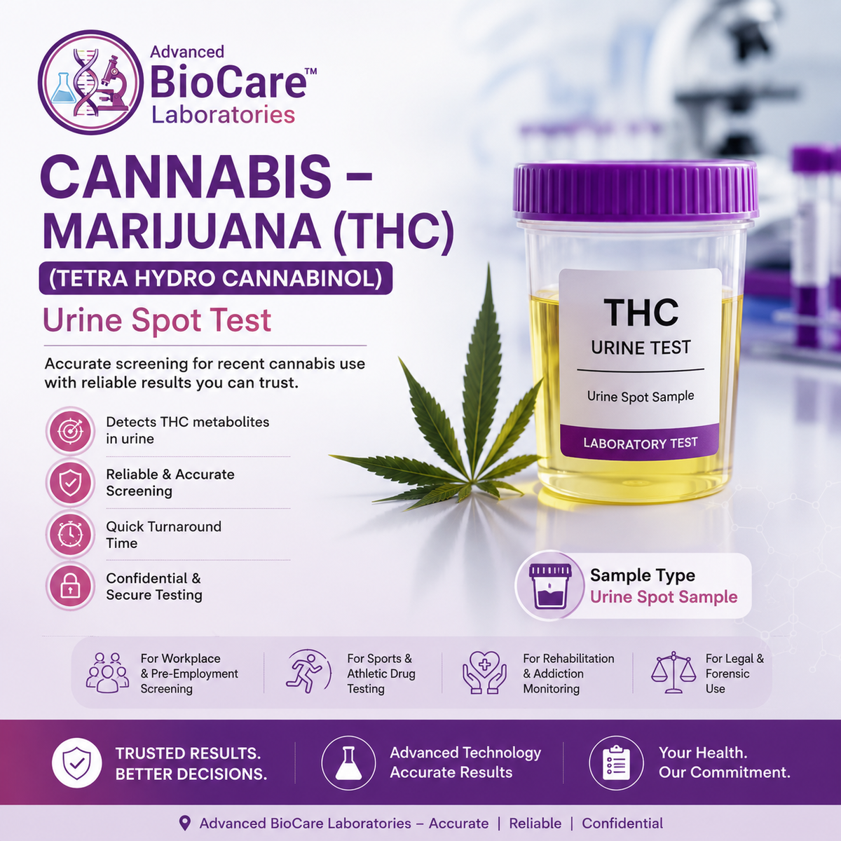 Cannabis - Marijuana (Tetra Hydro Canabinol), Urine Spot