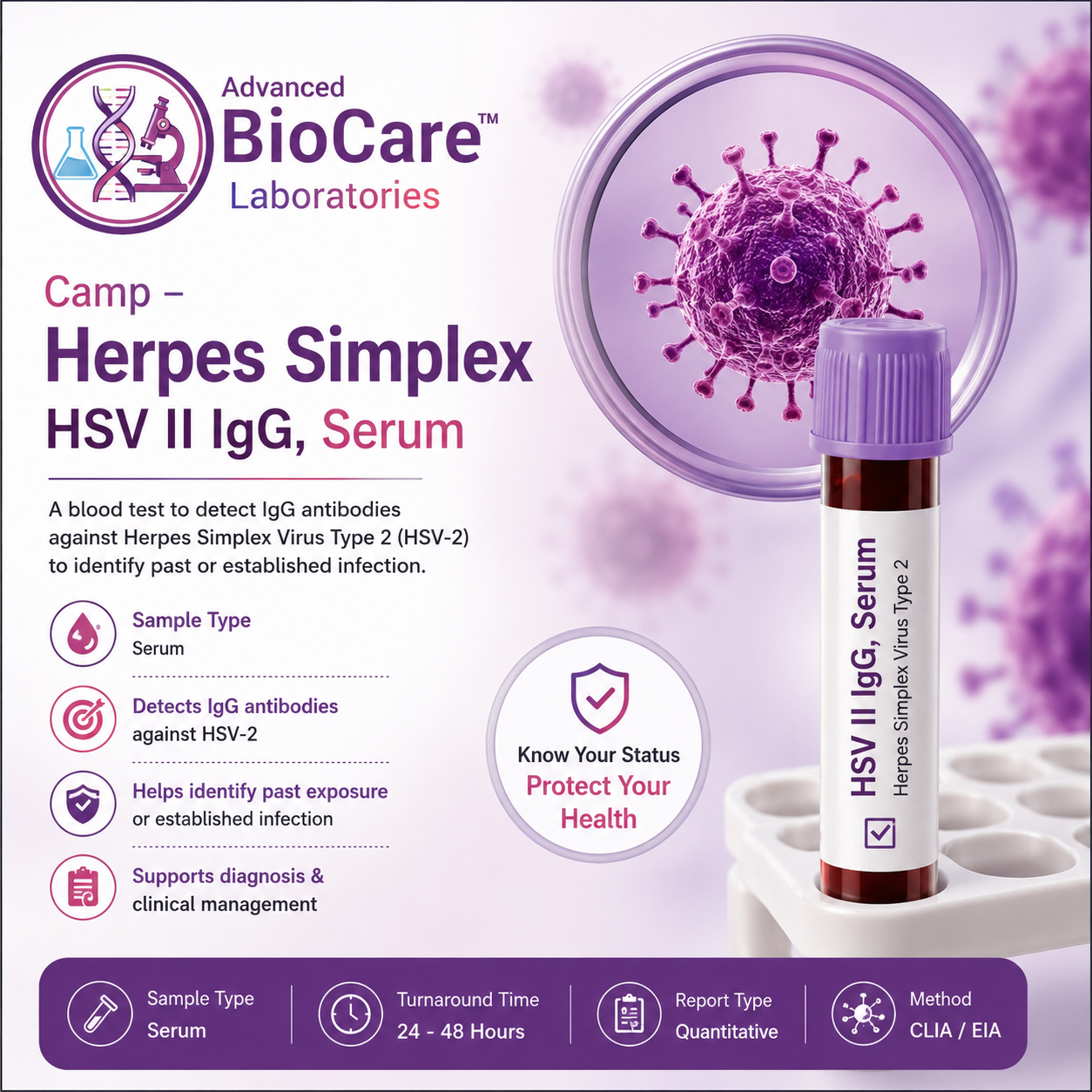 Herpes Simplex - HSV II IgG, Serum