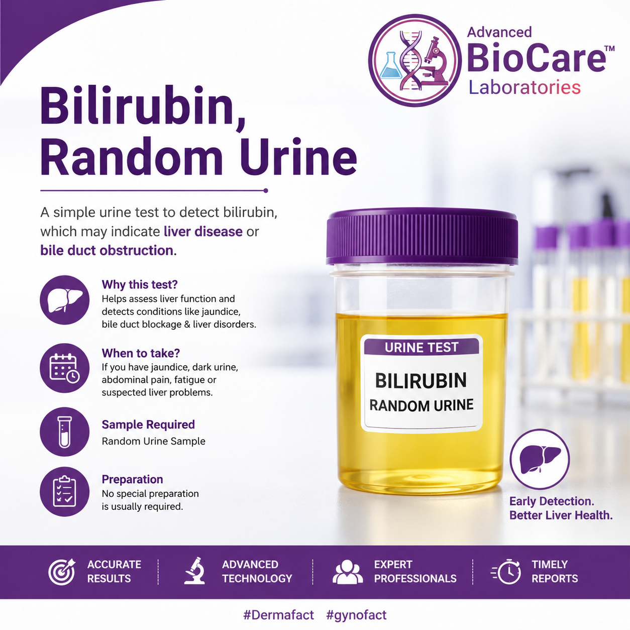 Bilirubin, Random Urine