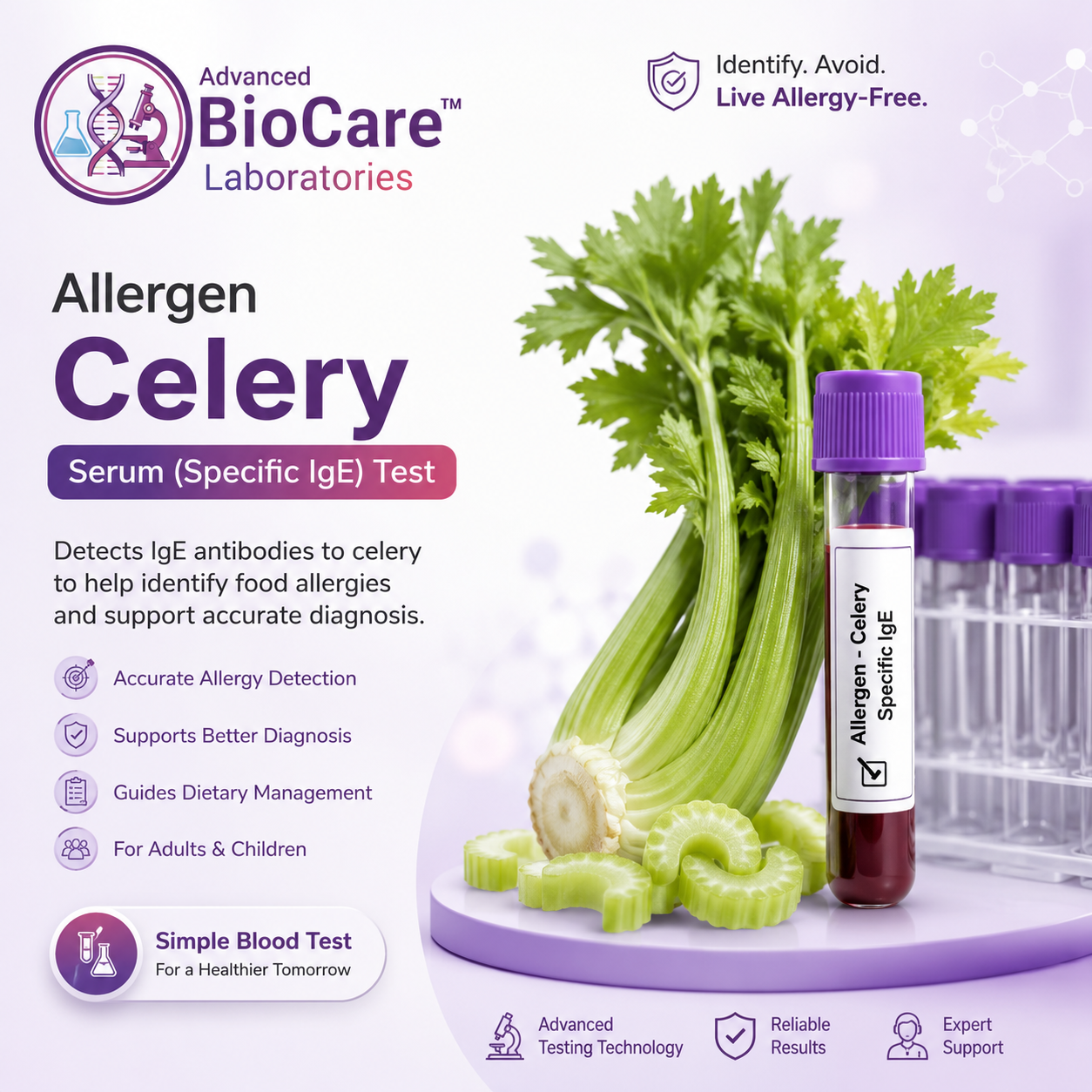 Allergen - CELERY by EIA, Serum