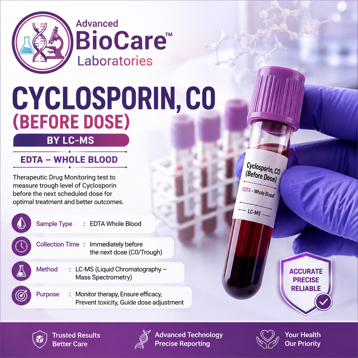 Cyclosporin, C0 (before dose), by LC-MS, EDTA-Whole Blood
