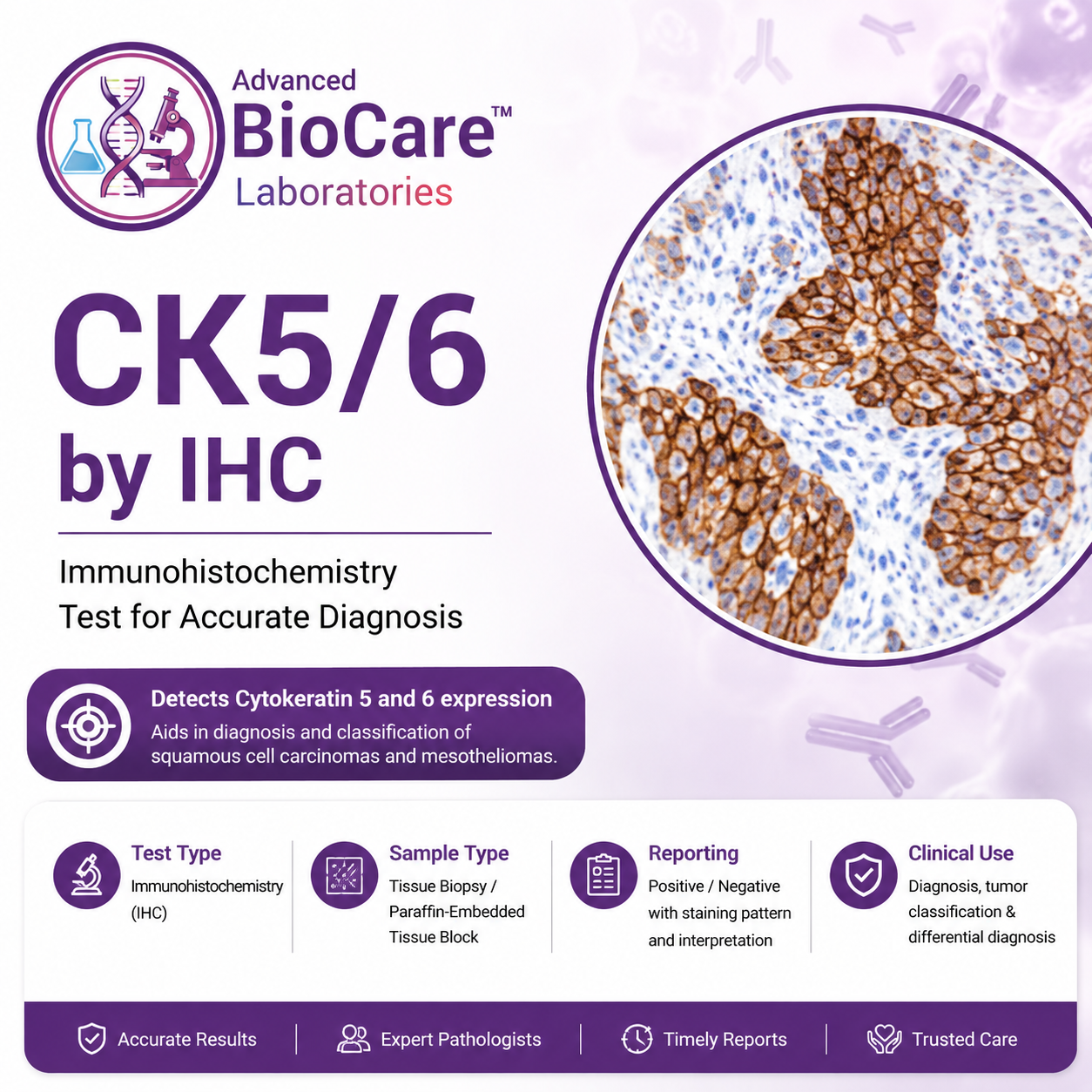 CK5/6 by IHC