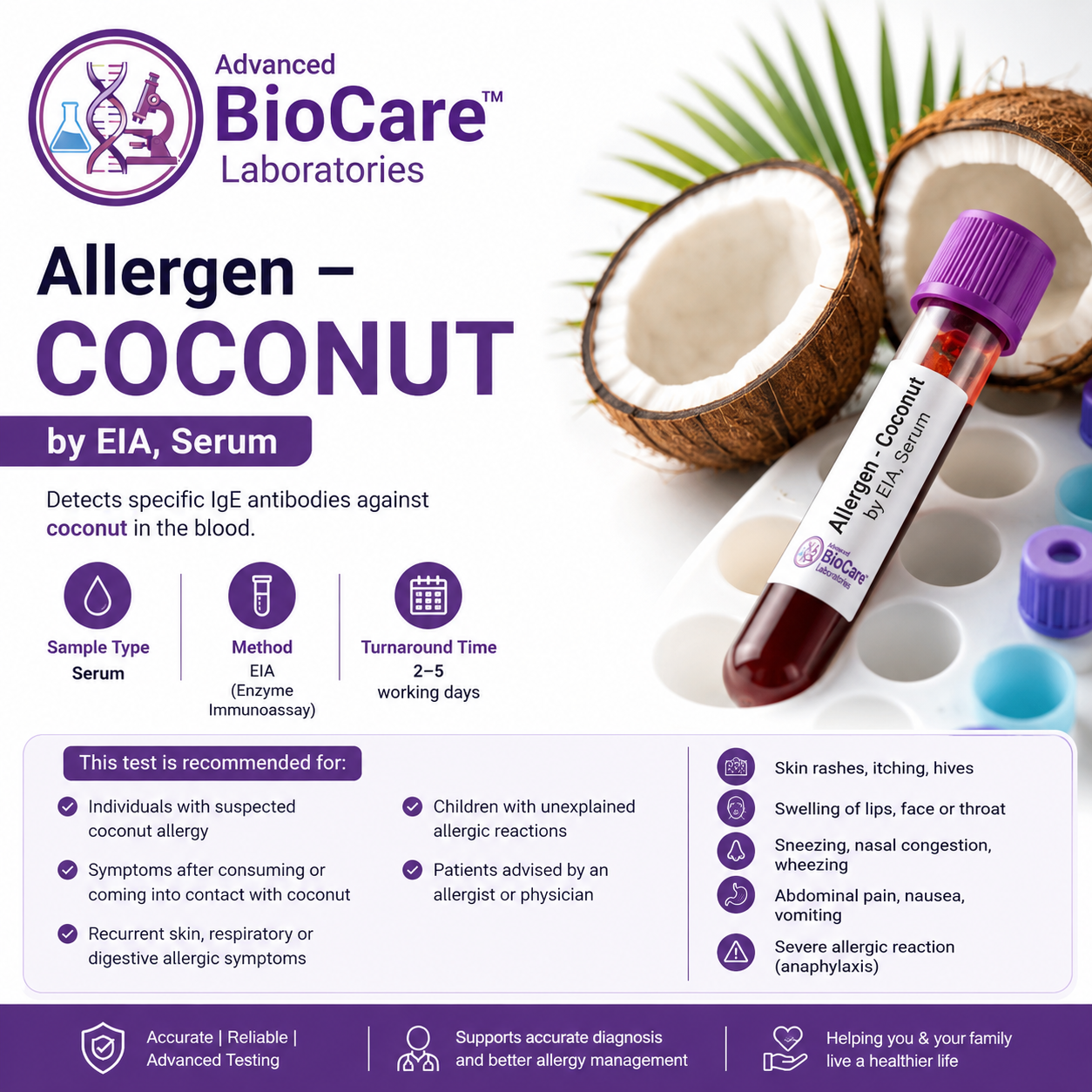 Allergen - COCONUT by EIA, Serum