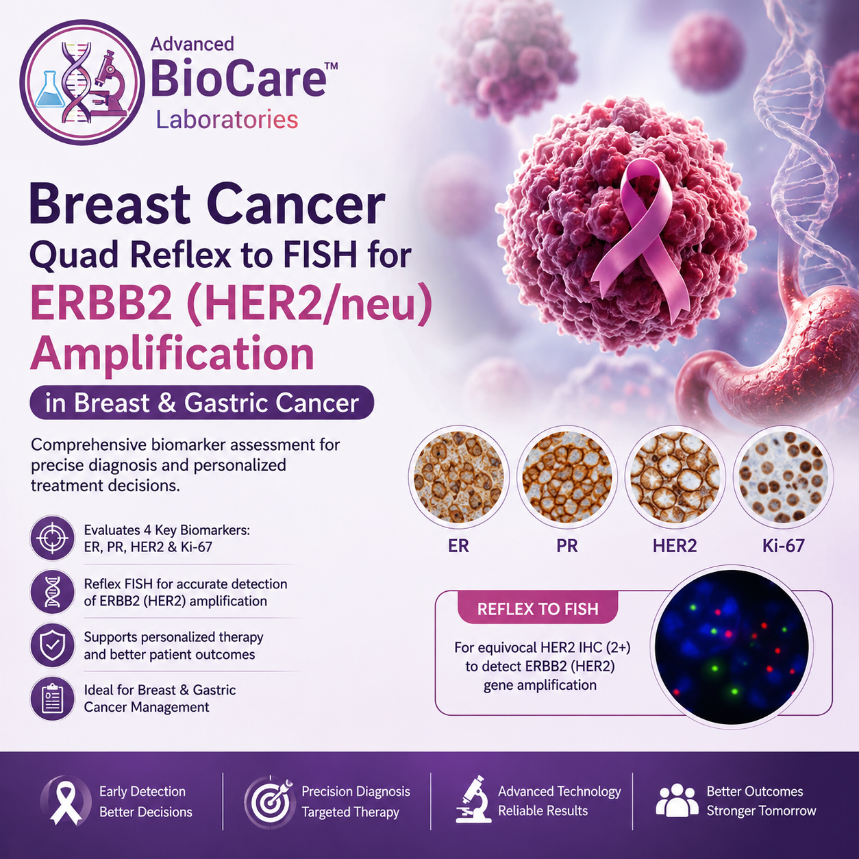 Breast Cancer Quad reflex to FISH for ERBB2 (HER2/neu) Amplification in Breast & Gastric cancer
