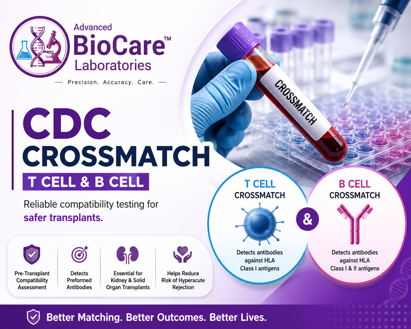 CDC Crossmatch (T cell & B cell)