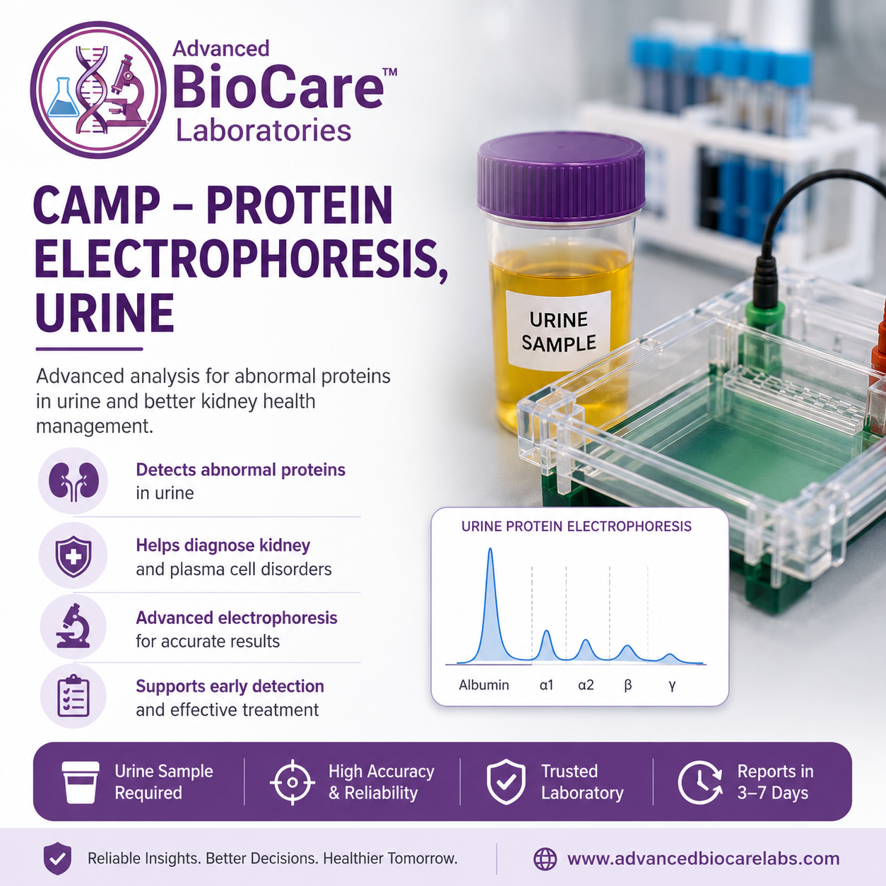 Protein Electrophoresis, Urine