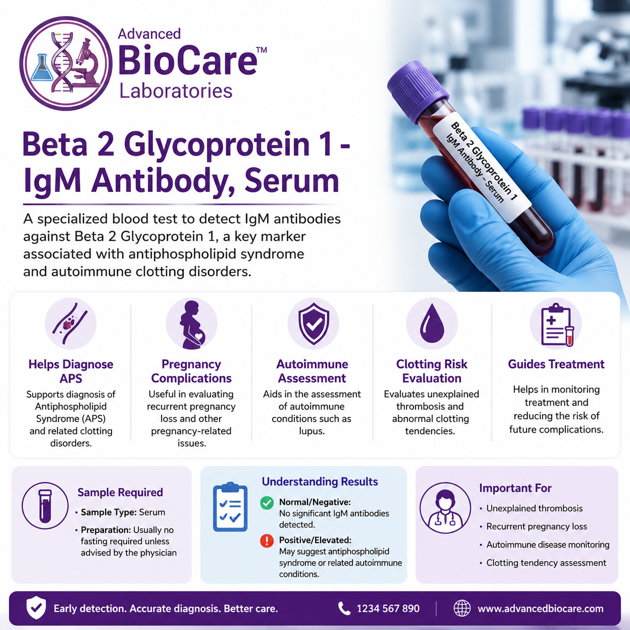 Beta 2 Glycoprotein 1 - IgM Antibody, Serum