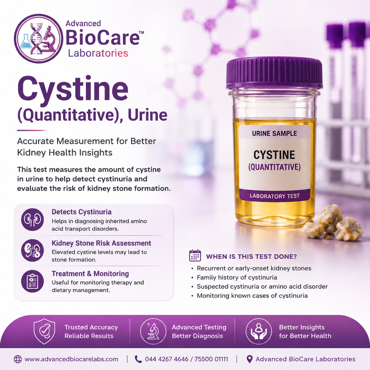 Cystine (Quantitative), Urine