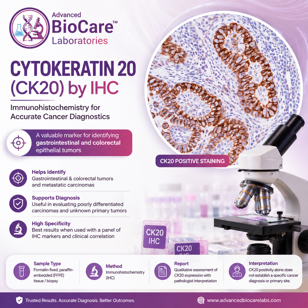 CYTOKERATIN 20 by IHC