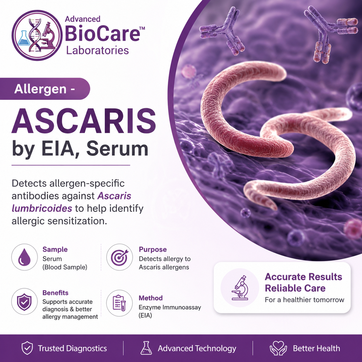 Allergen - ASCARIS by EIA, Serum
