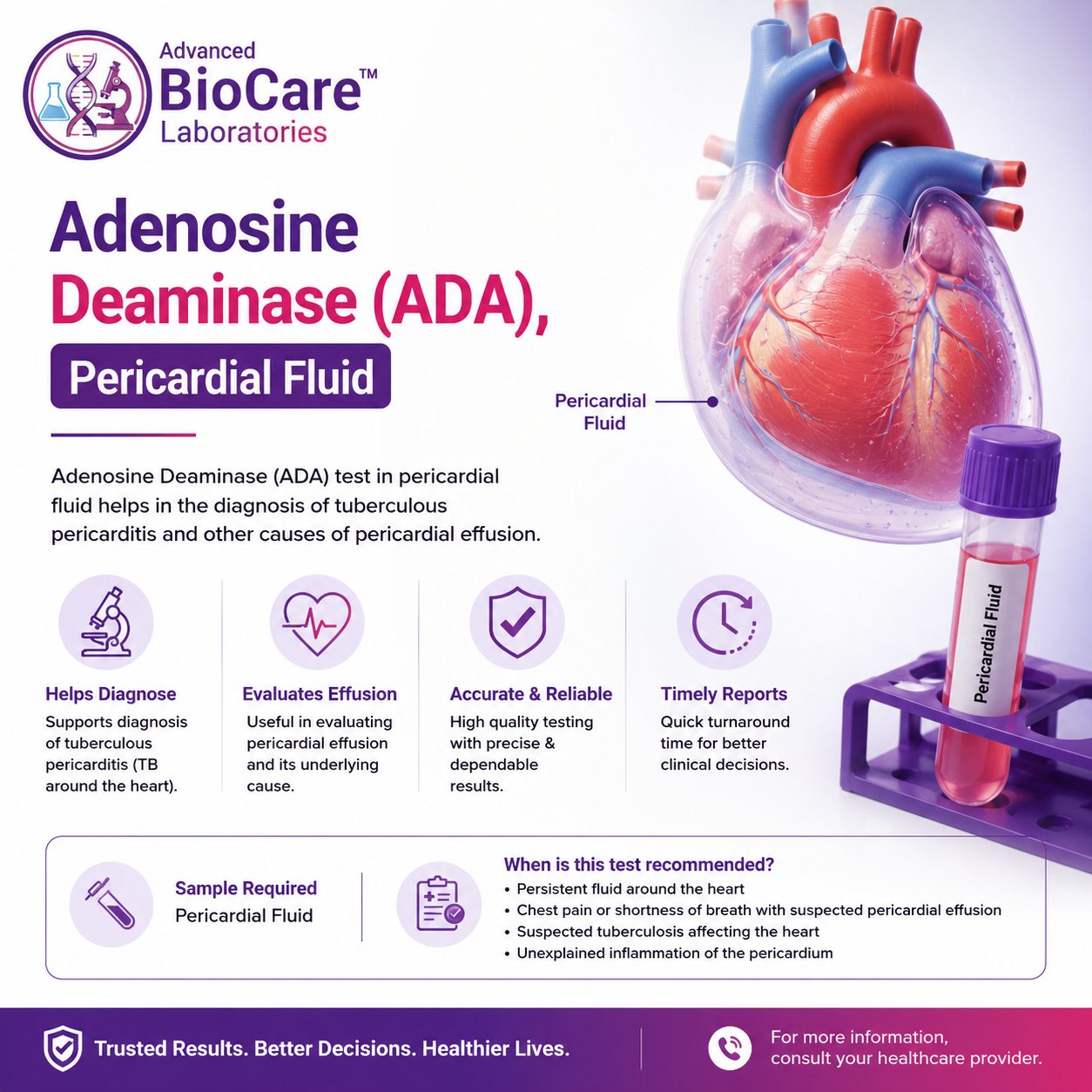 Adenosine Deaminase(ADA), Pericardial Fluid