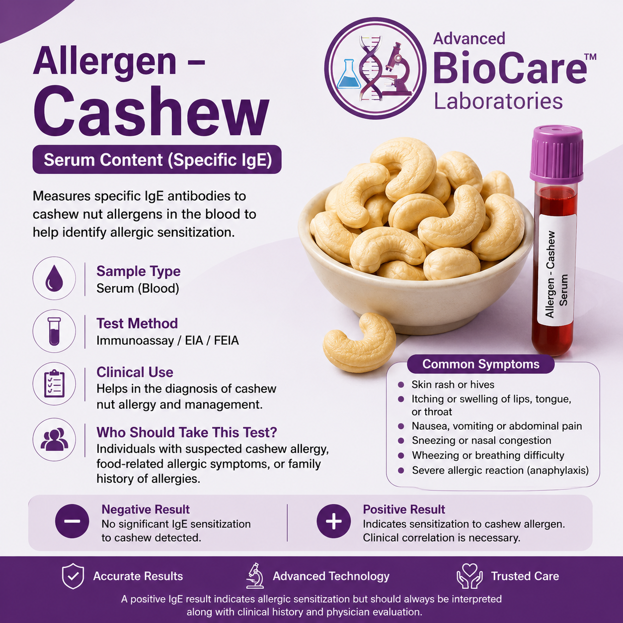 Allergen - CASHEW NUT by EIA, Serum