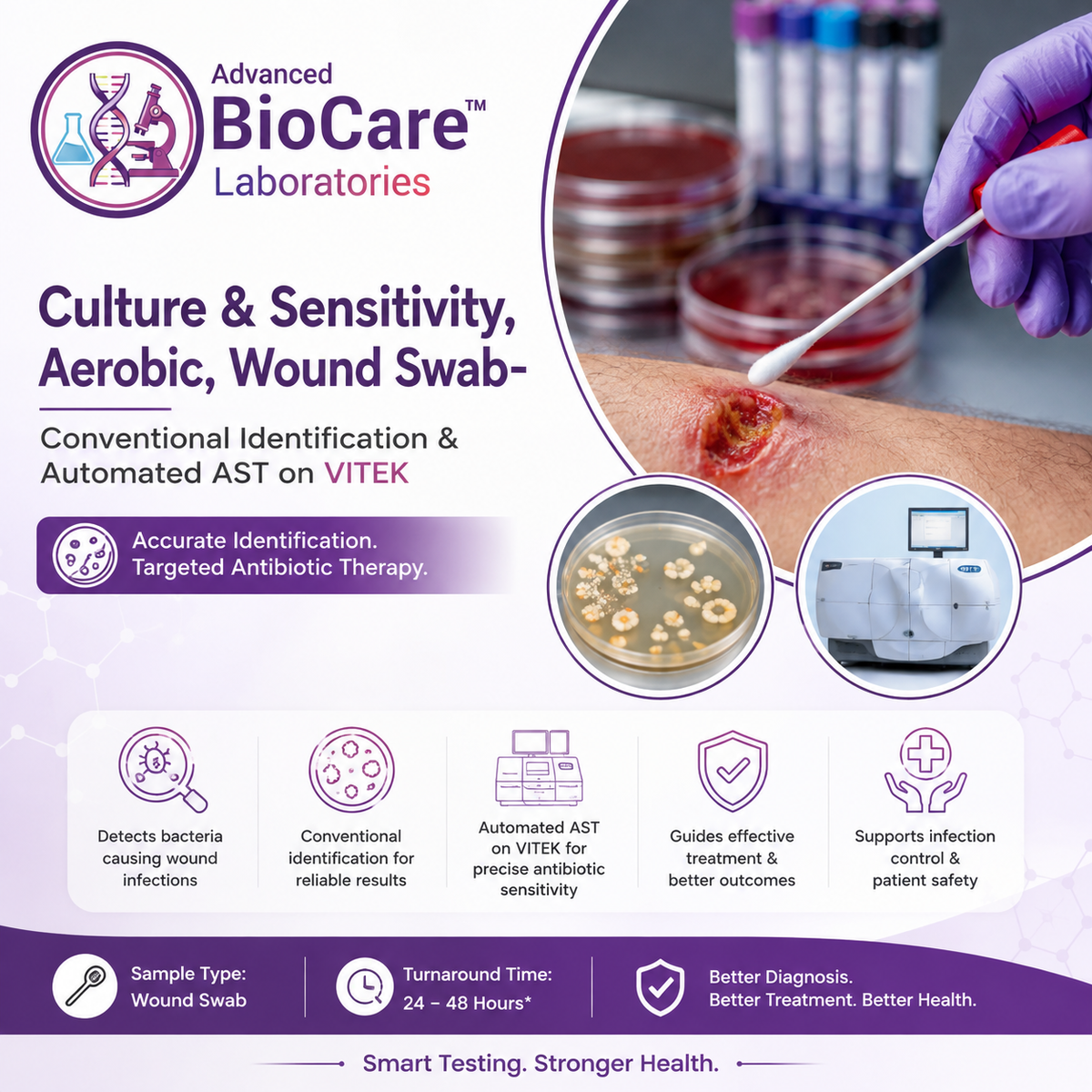 Culture & Sensitivity, Aerobic, Wound Swab- Conventional Identification & Automated AST on Vitek